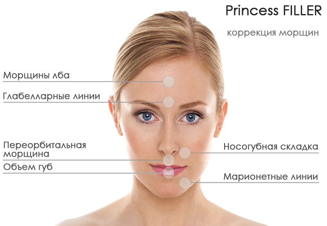 Филлеры принцесс – новый подход к омоложению кожи