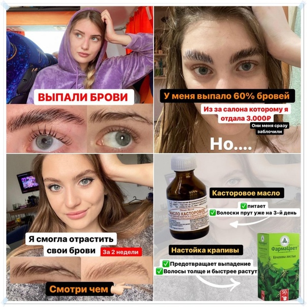 Как можно отрастить густые брови за 30 дней в домашних условиях