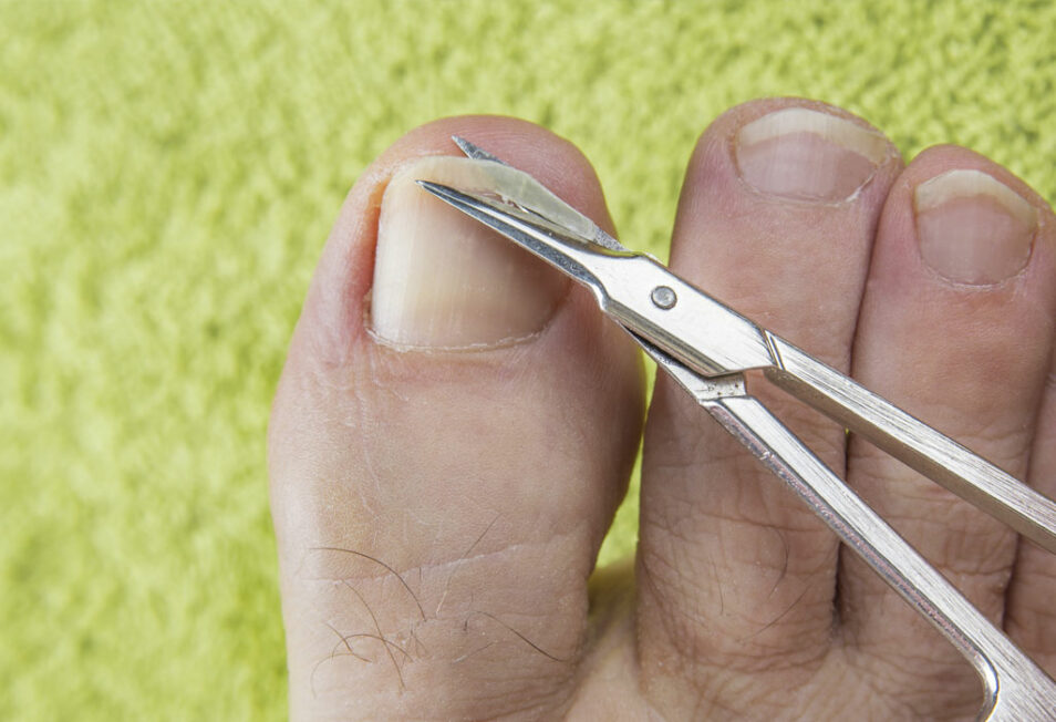 Как правильно стричь ногти?