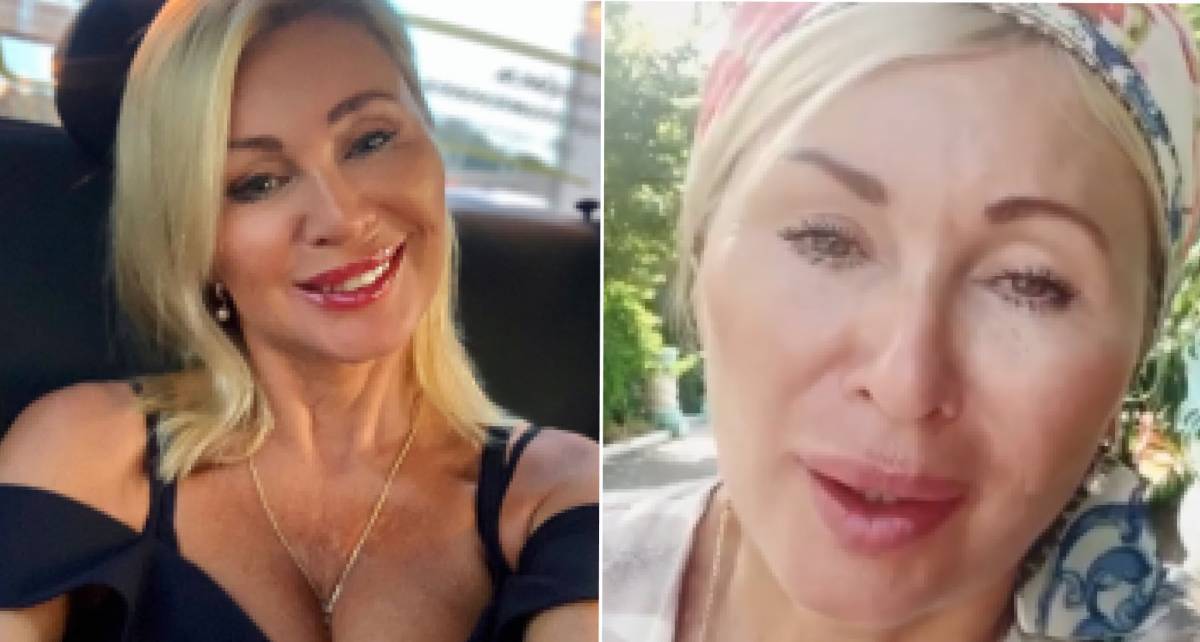 Виктория цыганова до и после операции: как выглядит вика после пластики +фото и видео