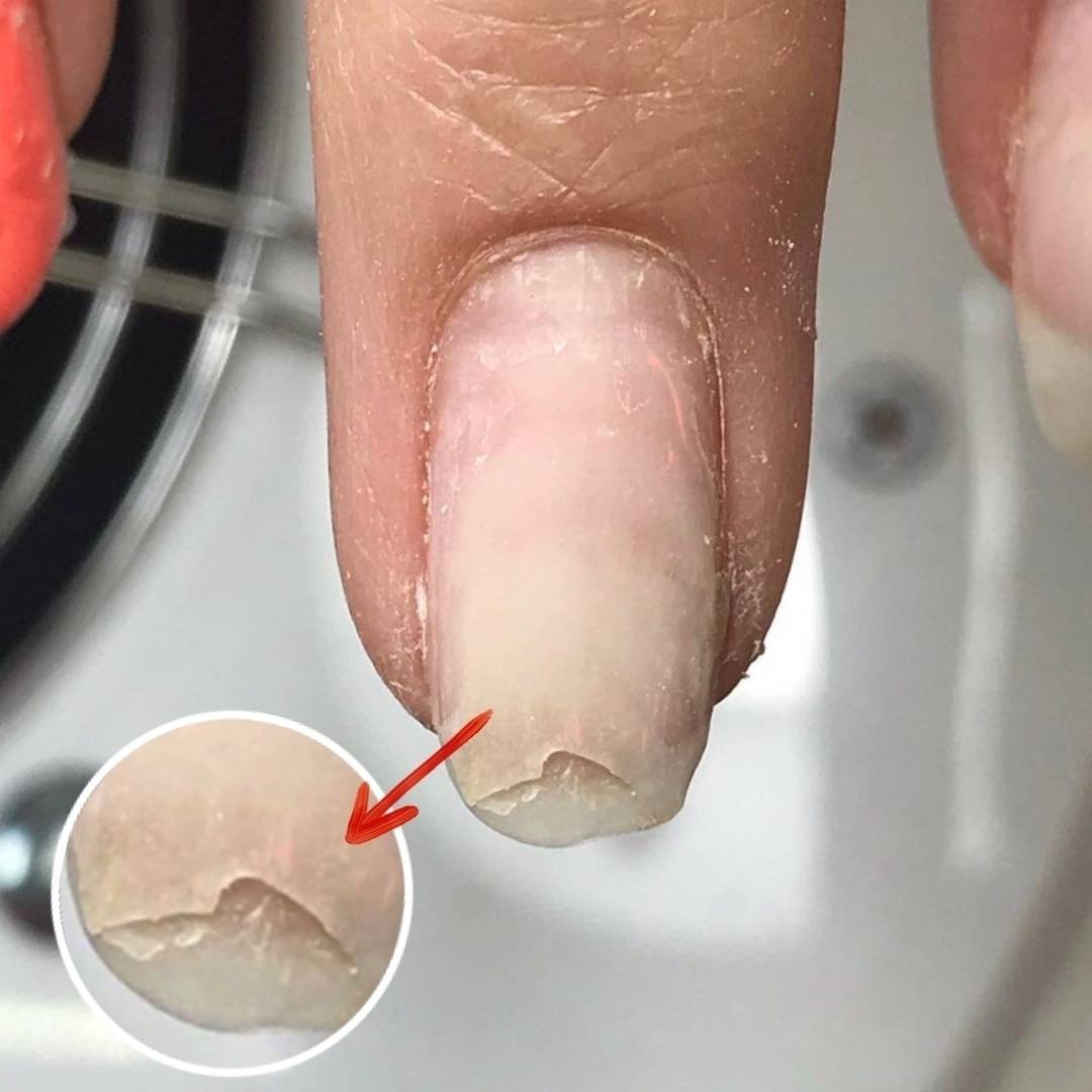 Почему трескается гель-лак на ногтях – причины и решение проблем