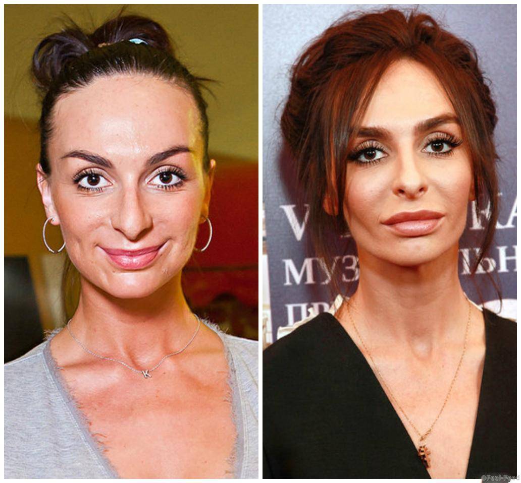 Екатерина варнава до и после пластики: лучше или хуже стало актрисе с новой внешностью?