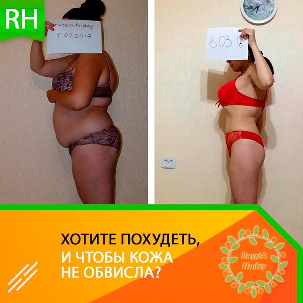 Как худеть, чтобы не было обвисшей кожи | официальный сайт – “славянская клиника похудения и правильного питания”