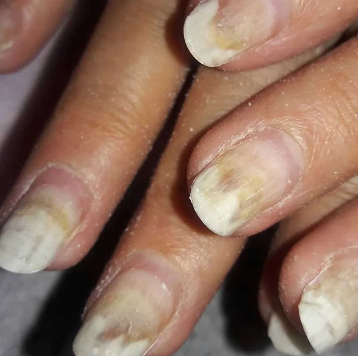 Вредно ли наращивать себе ногти? считается, что это приводит к проблемам