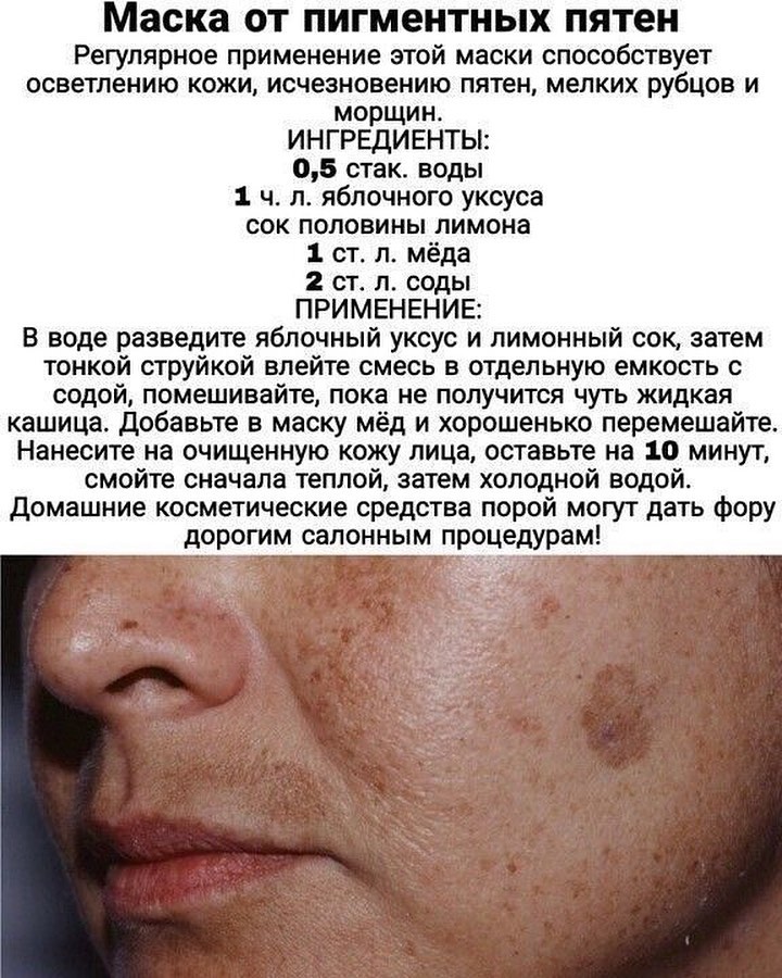 Старческие пятна на коже или солнечный гиперкератоз лечение в skinlazermed