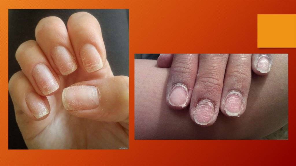 Вреден ли гель лак для ногтей и здоровья в целом | prostonail