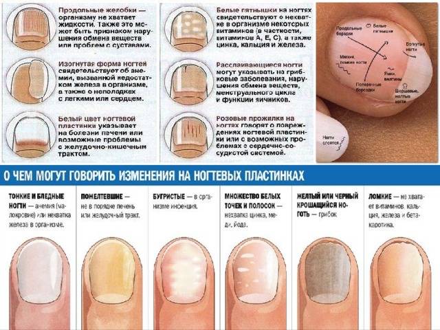 Самые распространенные болезни ногтей: справочная информация