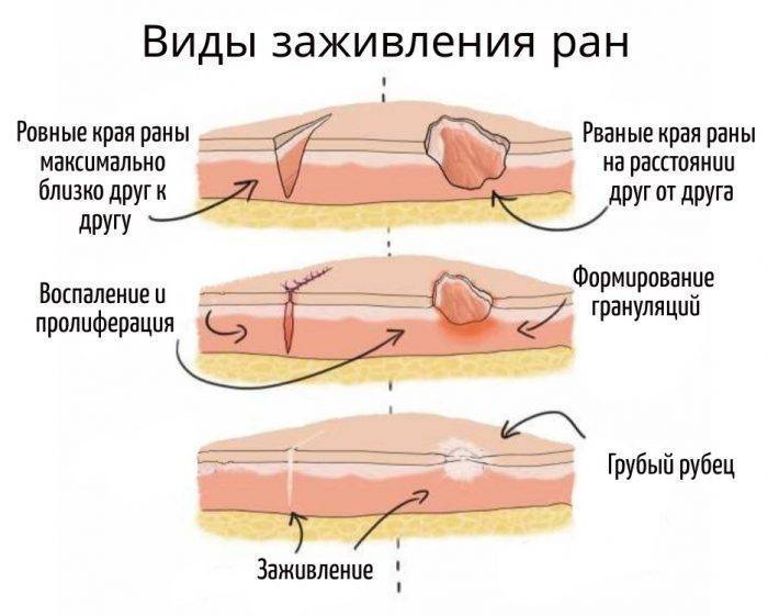Лучшая мазь для заживления ран 2022 года: обзор (топ-10) популярных препаратов
