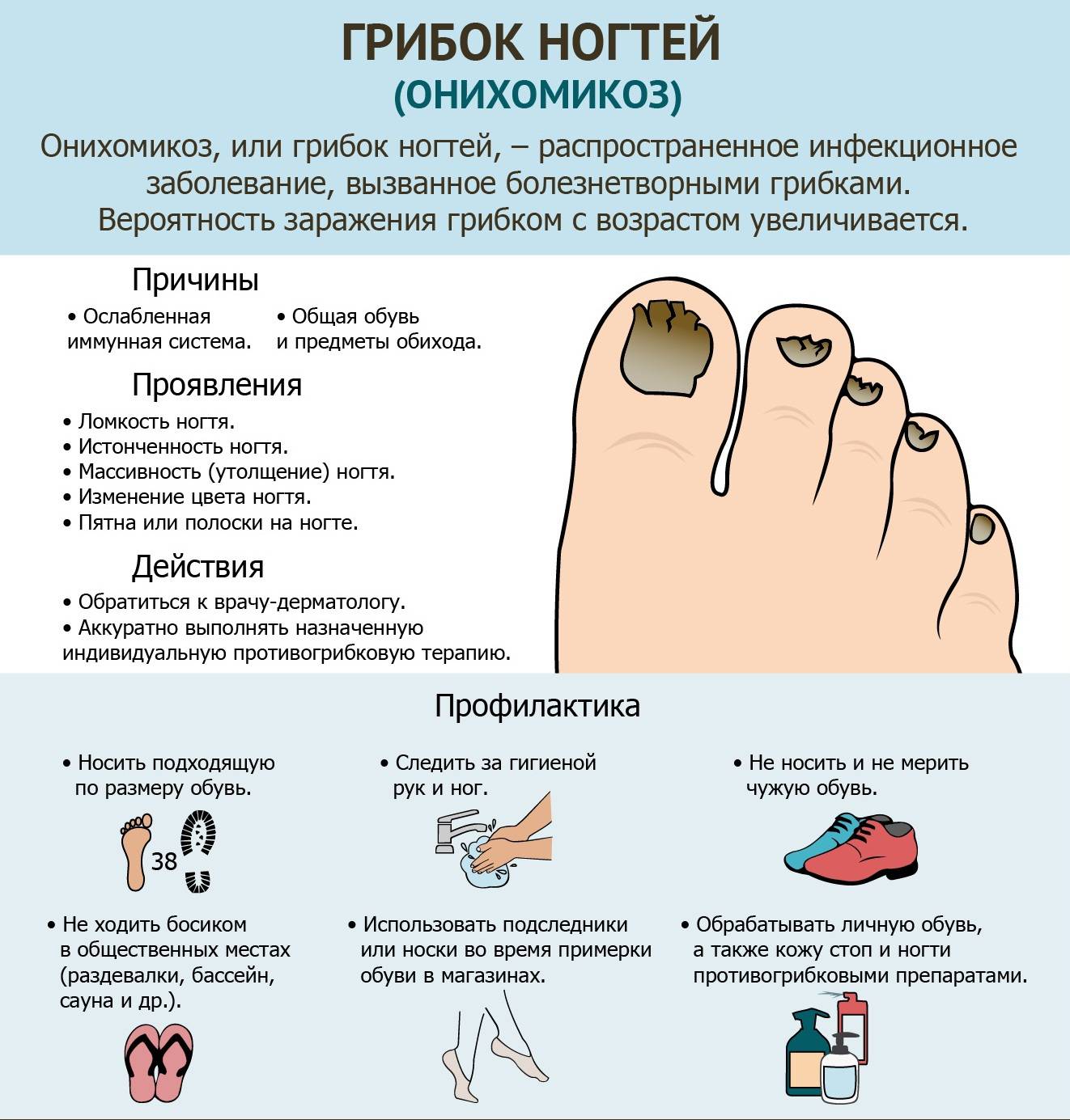Грибок ногтей на ногах и руках: фото, симптомы и лечение онихомикоза – напоправку