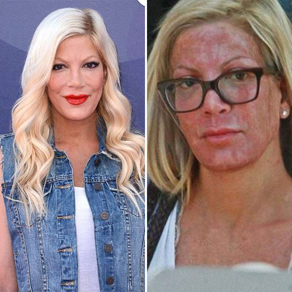 Как выглядели эти поп-звезды до и после пластической операции | кино новости