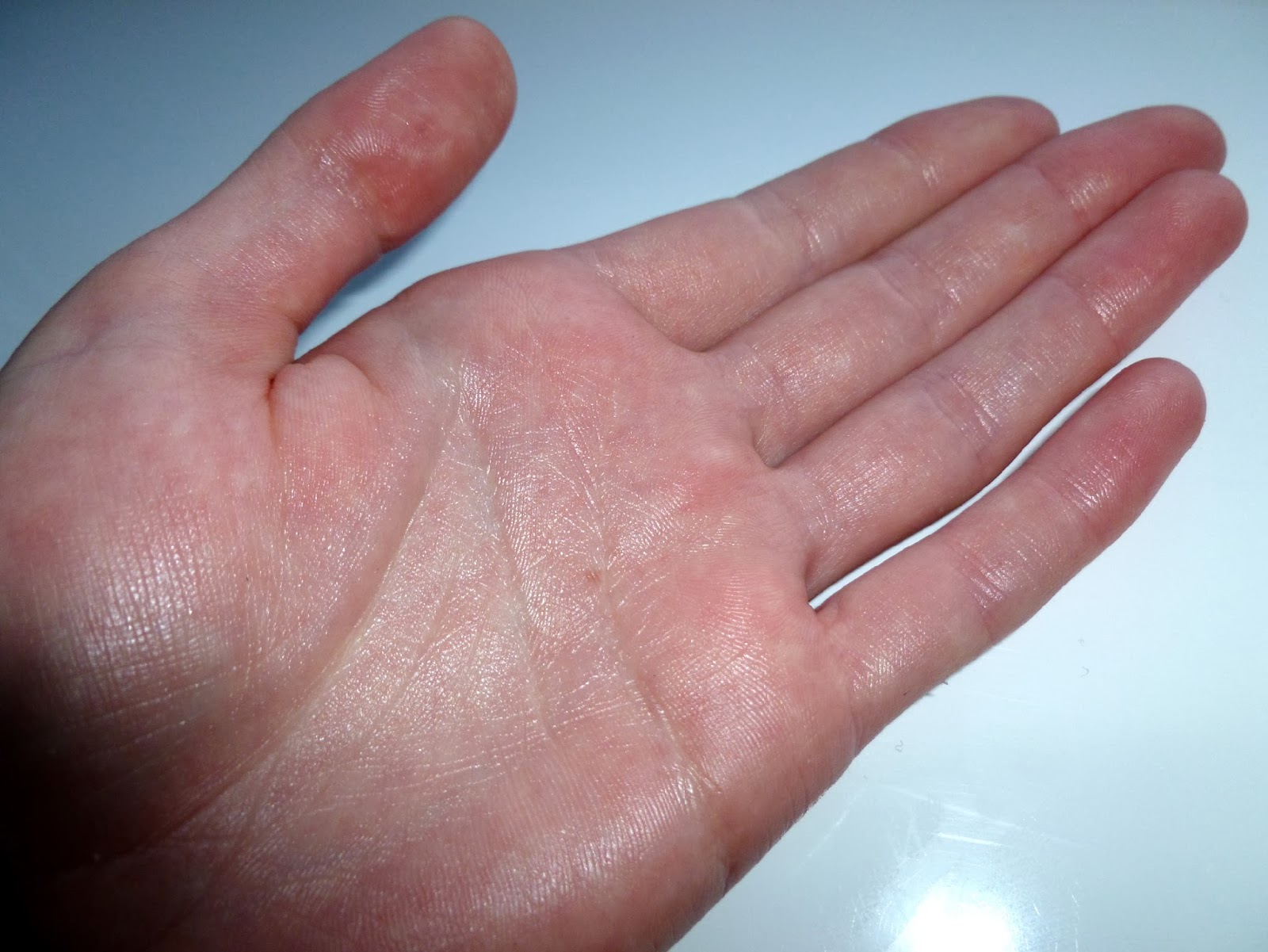 Подушечки пальцев рук шелушатся. почему шелушится кожа на пальцах рук?