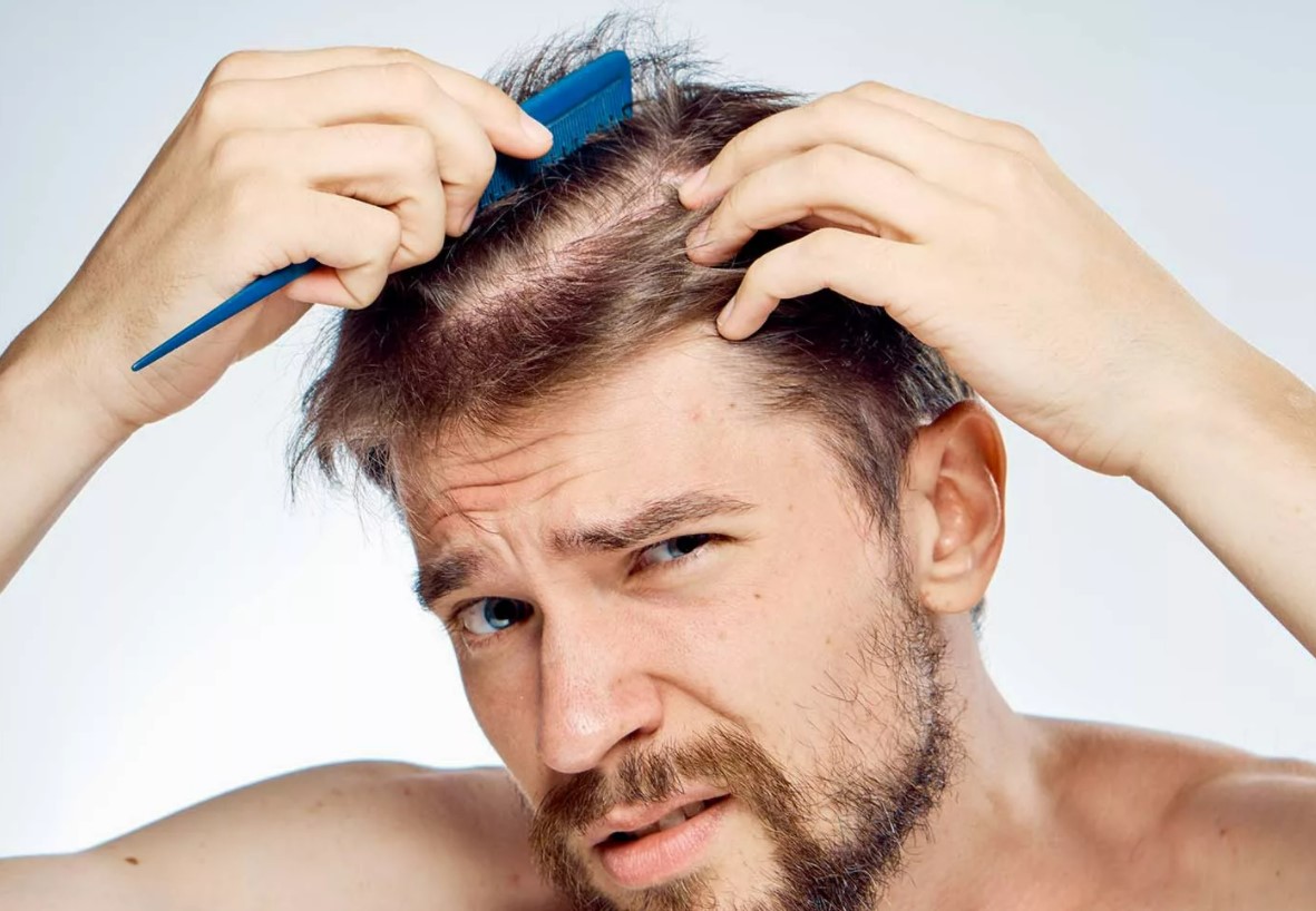Как остановить выпадение волос у мужчины: эффективные методы и средства | клиника hfe | дзен