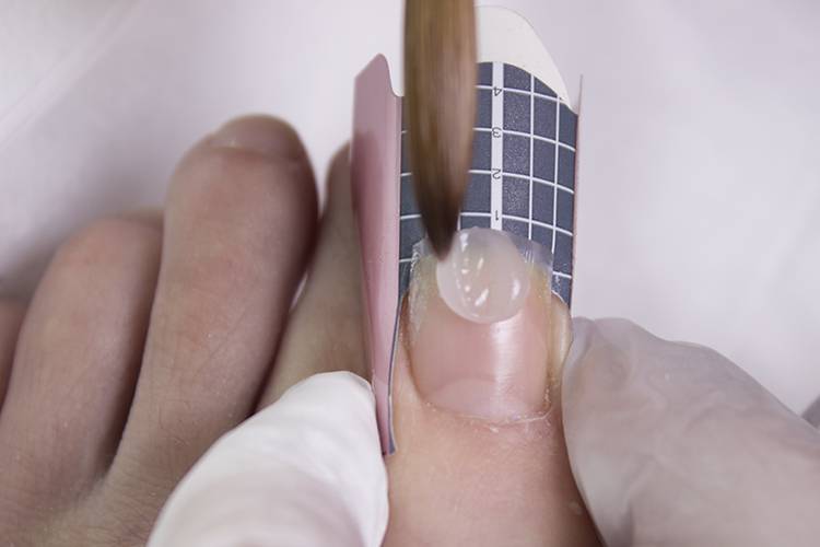 Технология и пошаговая инструкция наращивания ногтей на ногах с фото и видео