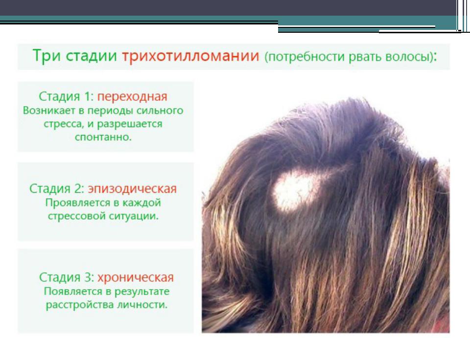 Выпадение волос у женщин [причины] — что делать если сильно выпадают волосы на голове