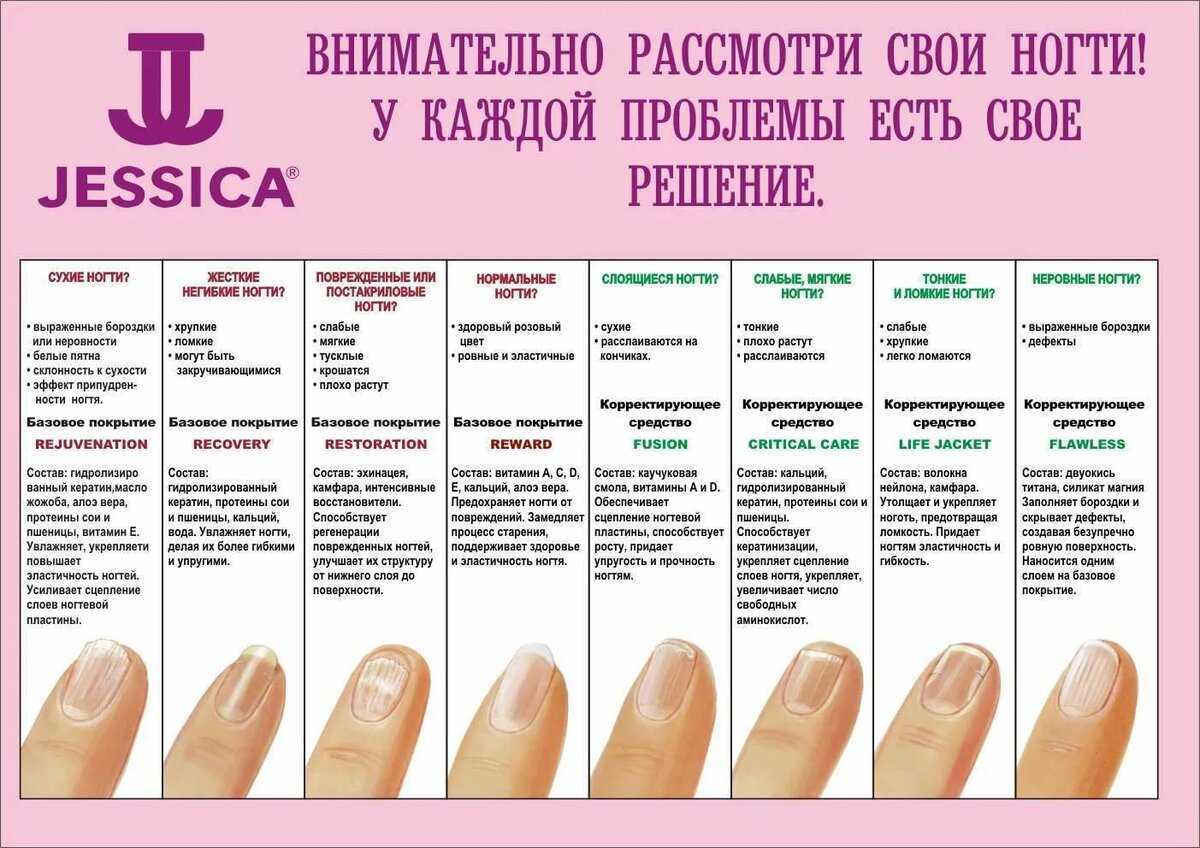 У ребенка слоятся ногти на руках: возможные причины, симптомы, лечение | mfarma.ru