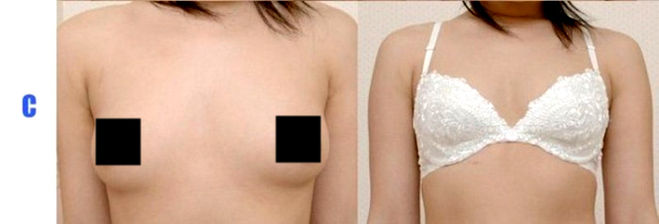 Первый размер груди: как измеряется, плюсы и минусы, советы по увеличению объема