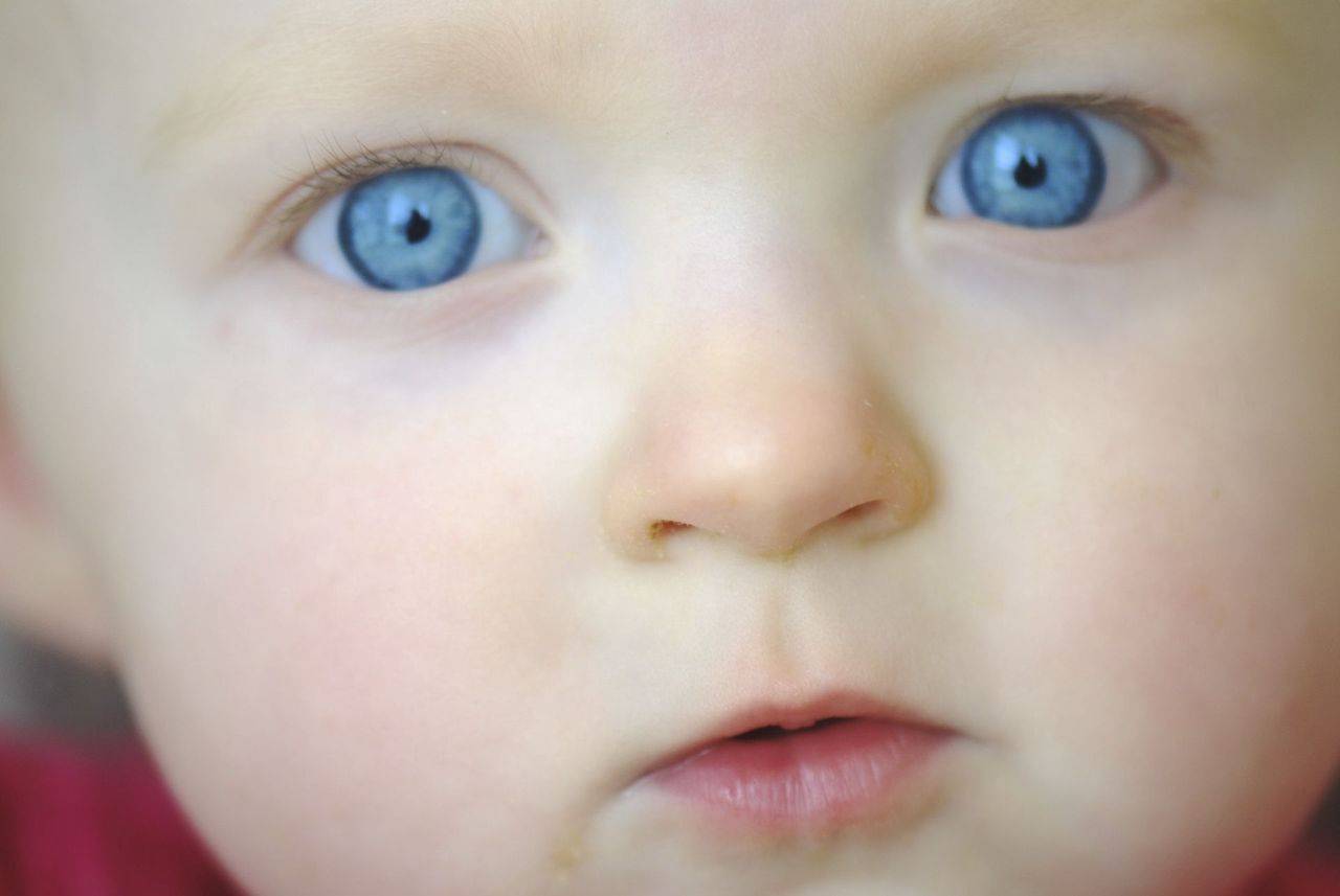 Красные круги под глазами у ребенка - что это, причины, лечение симптома