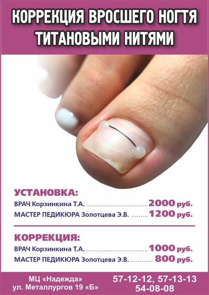 Гайд по диагностике заболевания ногтей — определяем и лечим