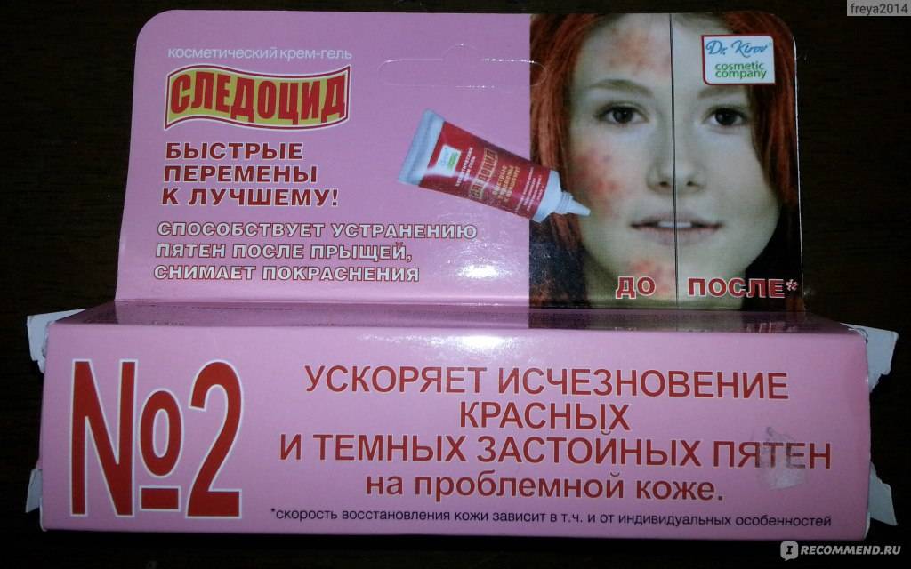 Как избавиться от постакне