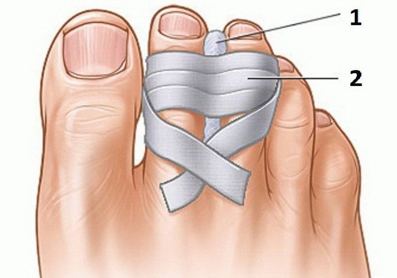 Что может обозначать боль в пальцах? причины и лечение боли в суставах пальцев рук и ног.