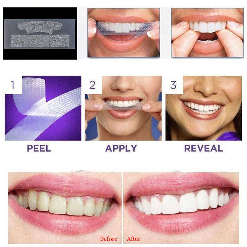 Топ-10 лучшие отбеливающие полоски для зубов: рейтинг, как выбрать, отзывы, характеристики