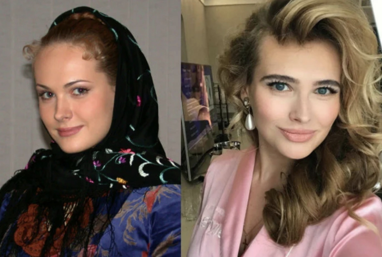 Анна горшкова: до и после пластики. как изменилась ее личная жизнь?