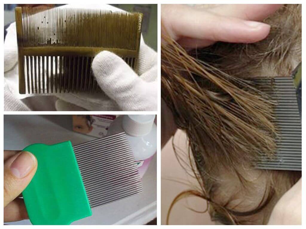 Как избавиться от пыли на волосах