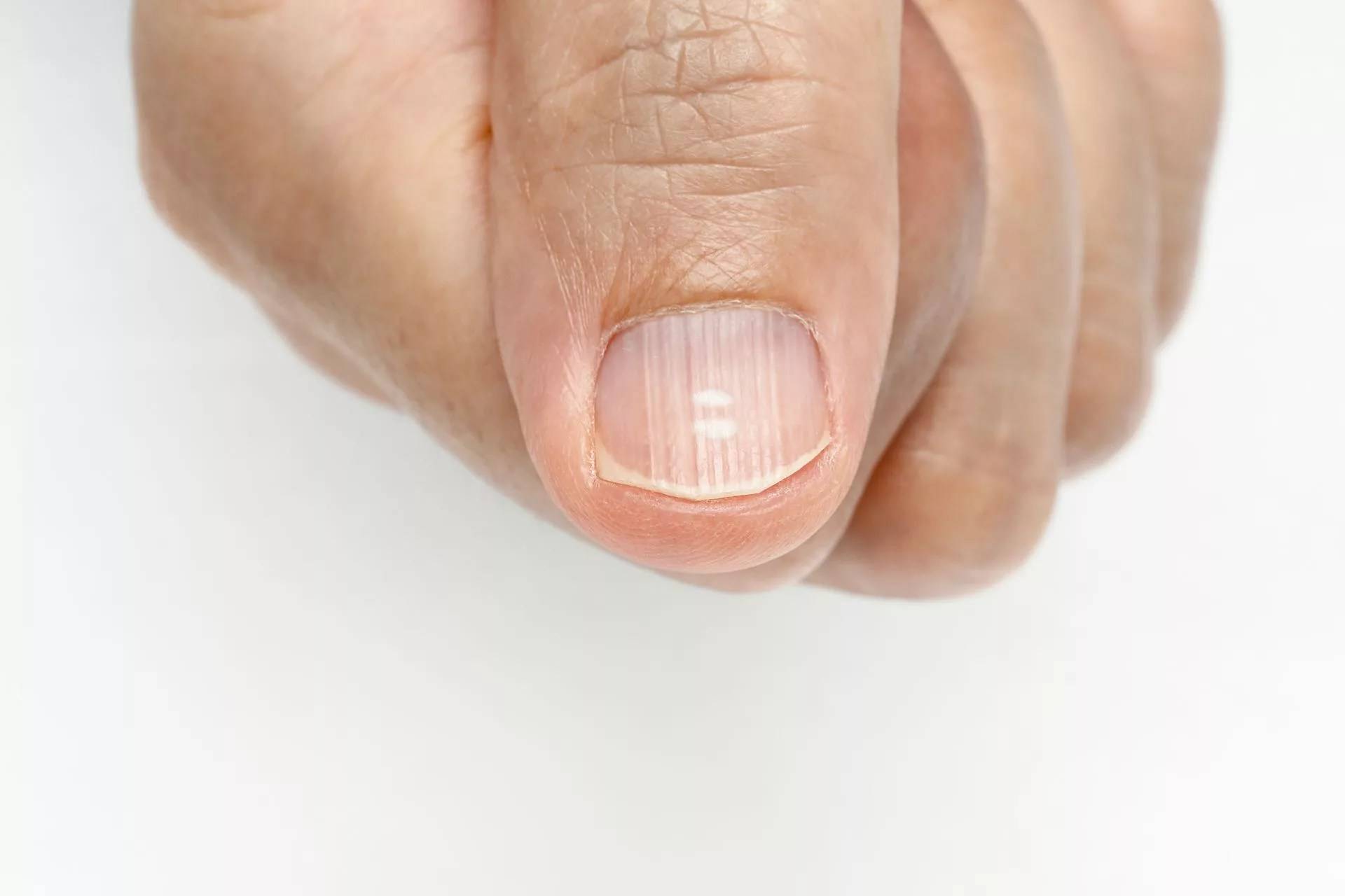 Состояние ногтей как показатель здоровья человека