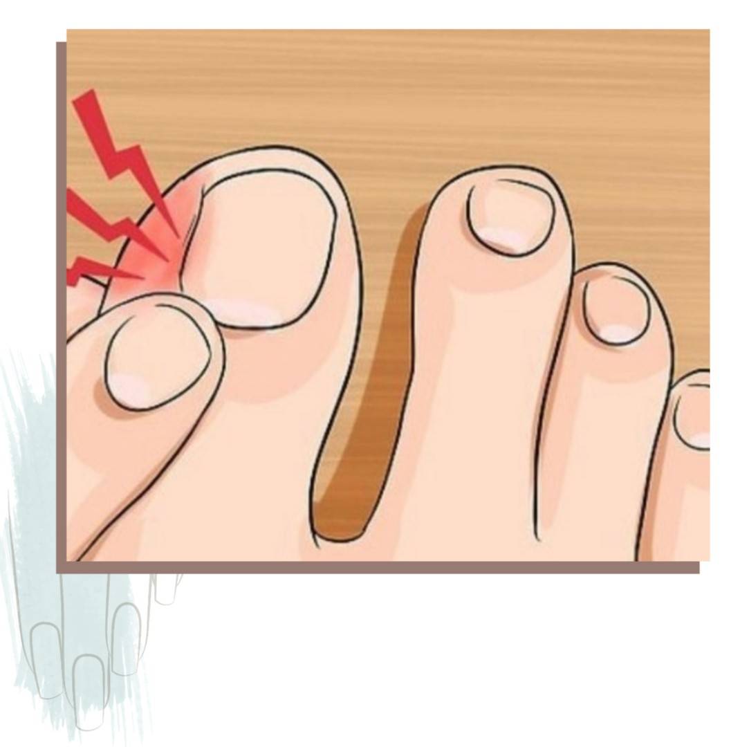 Как правильно стричь ногти на руках и на ногах