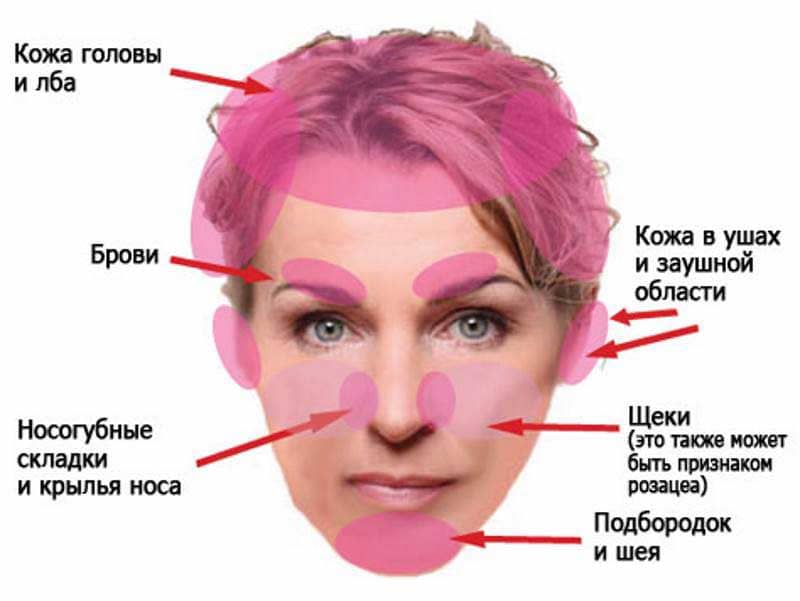 Сухость в носу, как избавиться от постоянной сухости слизистой носа у взрослых, причины и лечение заболевания
