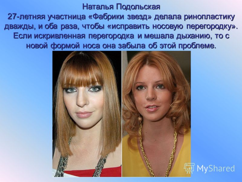 Наталья подольская сделала нос. подольская наталья до и после ринопластики: фото