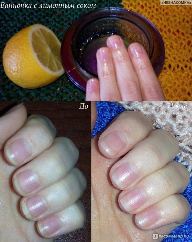 Как быстро отрастить ногти — modnail.ru — красивый маникюр