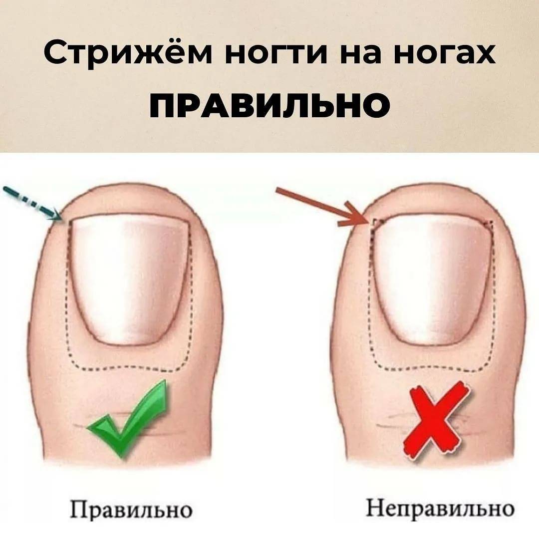 Как правильно стричь ногти на ногах – рекомендации, техника исполнения. | vrednuga.ru