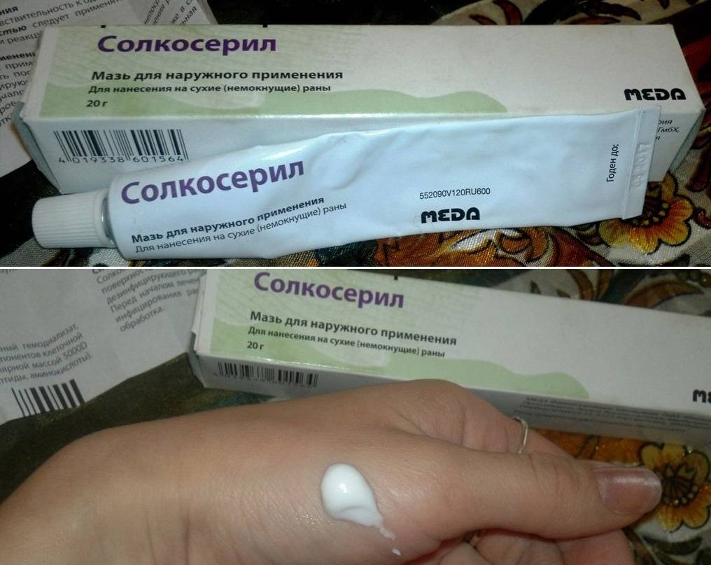 Солкосерил Мазь Цена Курск Купить