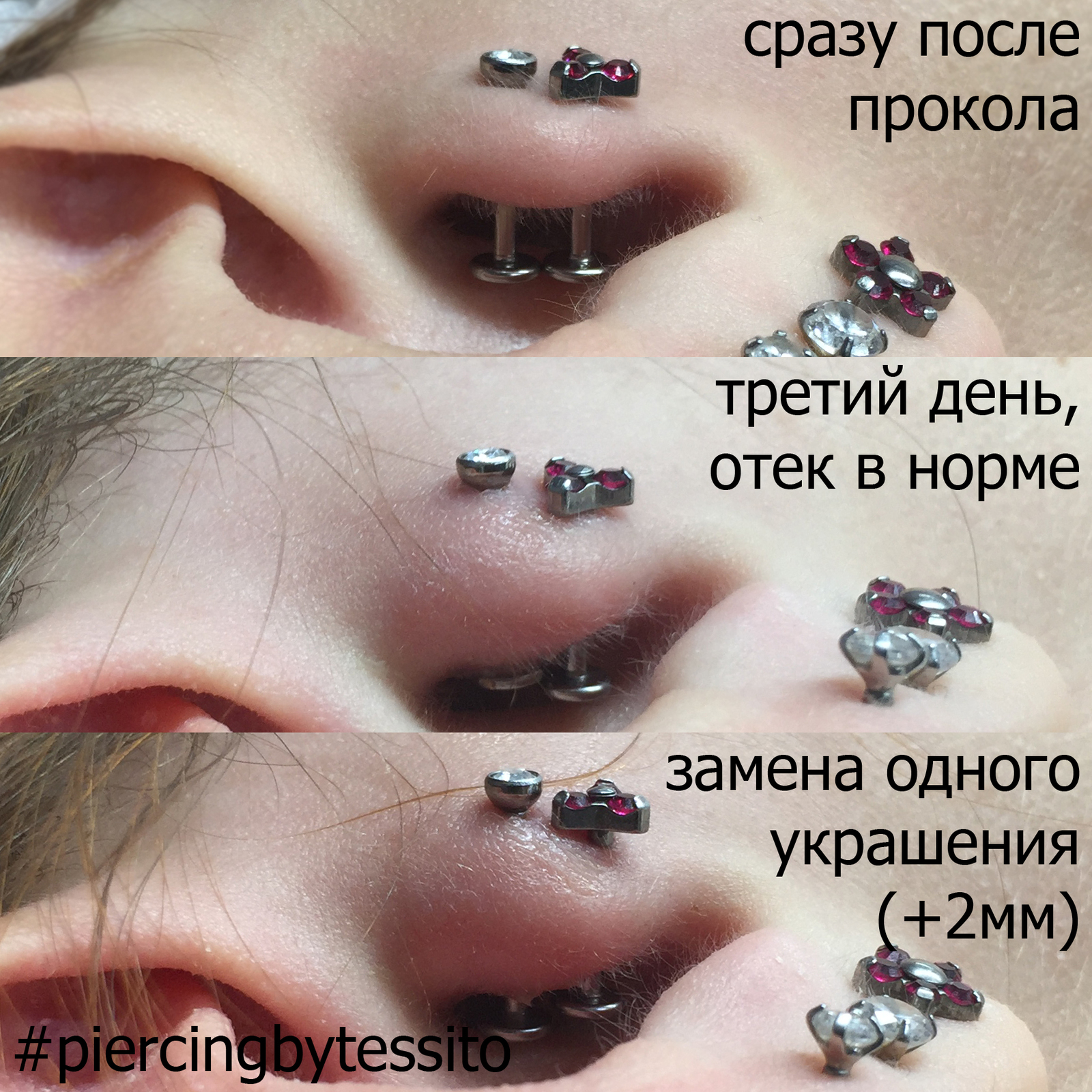 Как выглядит мочка после прокола