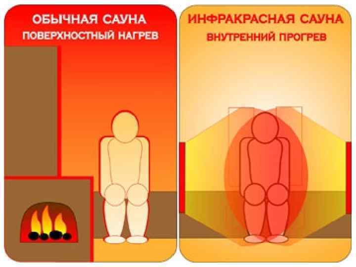 Инфракрасная сауна: что это такое, польза и вред для организма человека