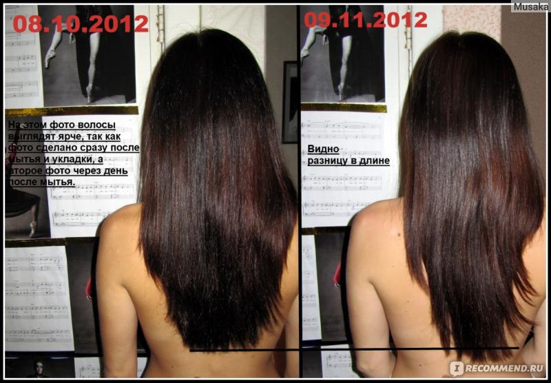 Как ускорить рост волос на голове у женщин в домашних условиях
как ускорить рост волос — modnayadama