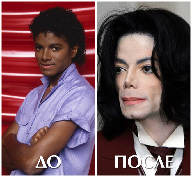 Майкл джексон до пластики, изменения лица после | marykay-4u.ru