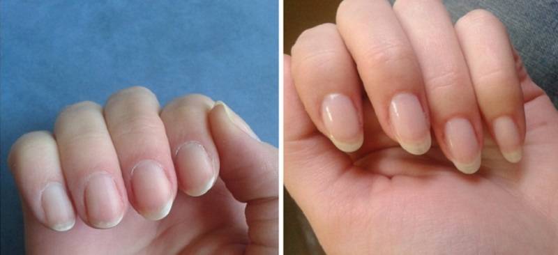 Как отрастить ногти за одну-две недели