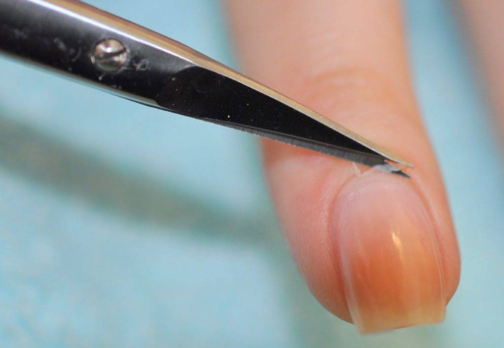 Способы размягчить ногти | как подстричь ногти на ногах пожилому человеку