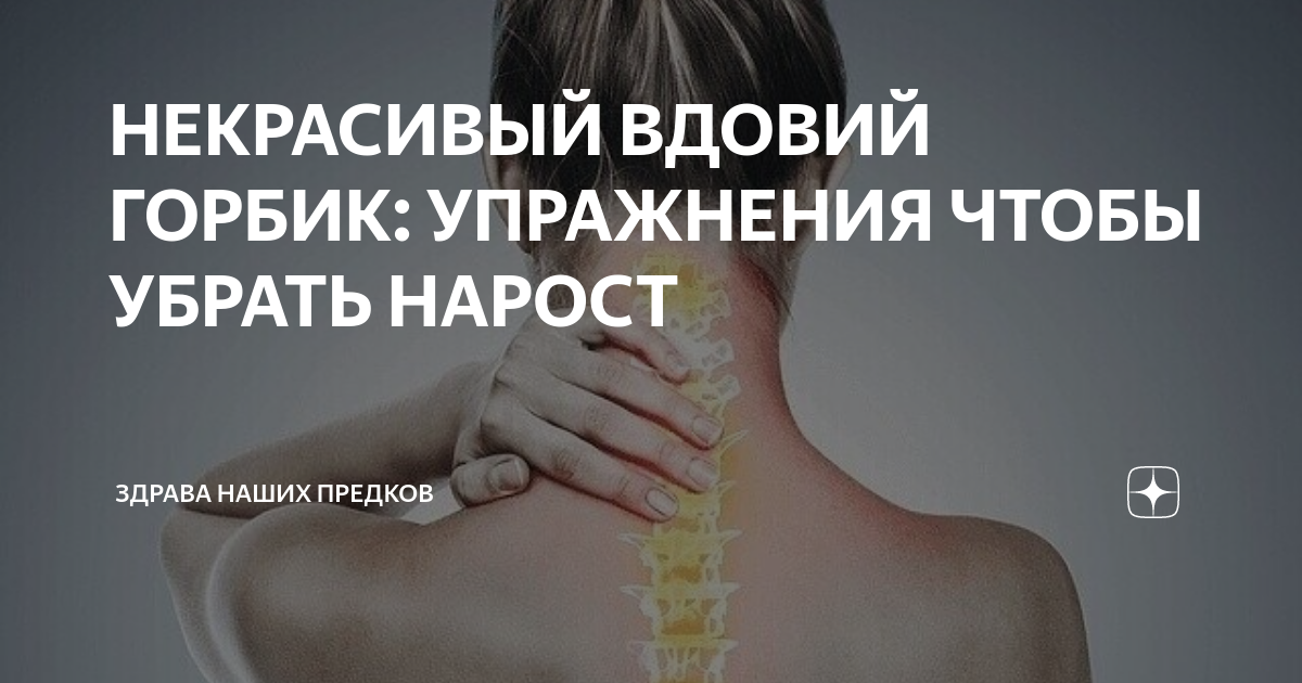Как убрать холку на шее: упражнения и массаж для удаления «вдовьего горба»