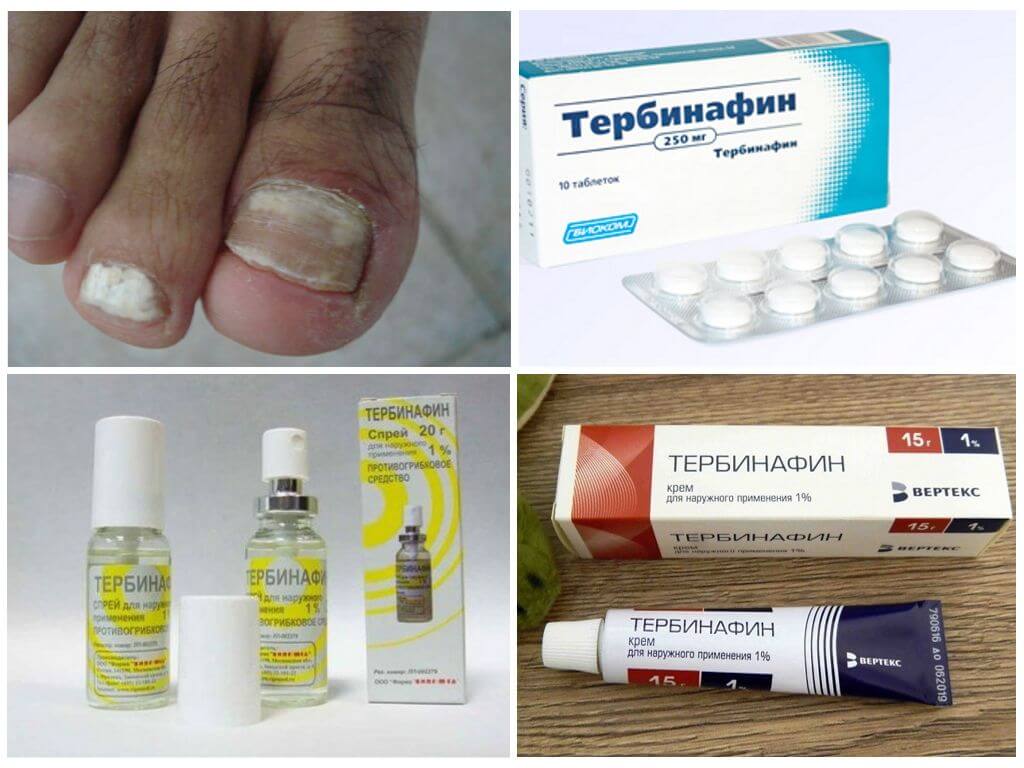 9 самых хороших и недорогих мазей от грибка ногтей на ногах