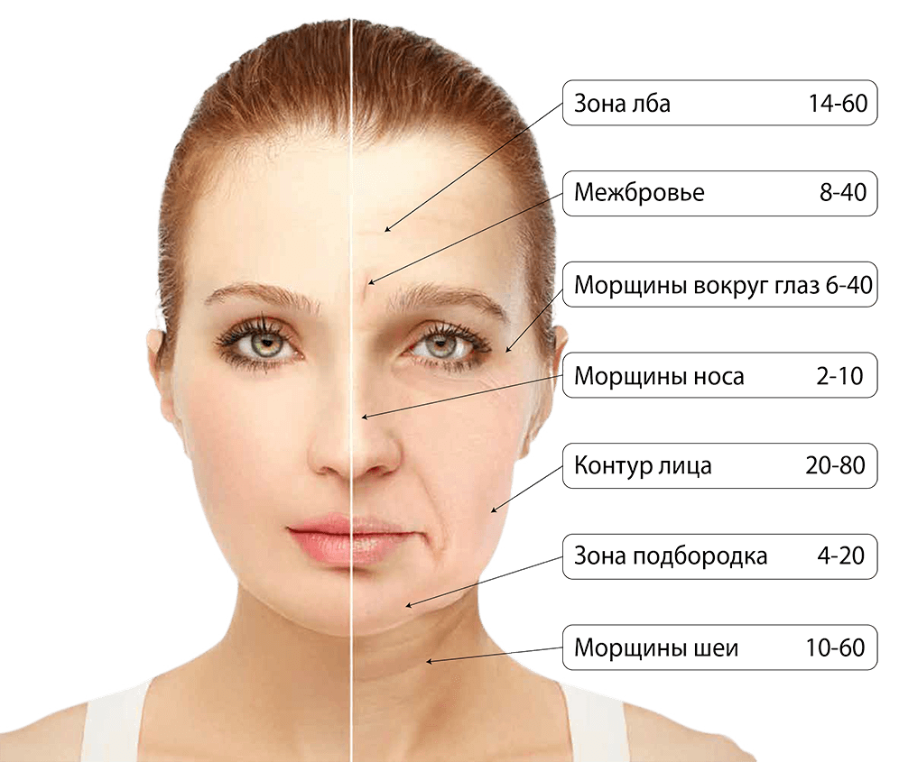 Невропатия лицевого нерва (неврит) ️: симптомы, признаки и причины, диагностика и лечение
