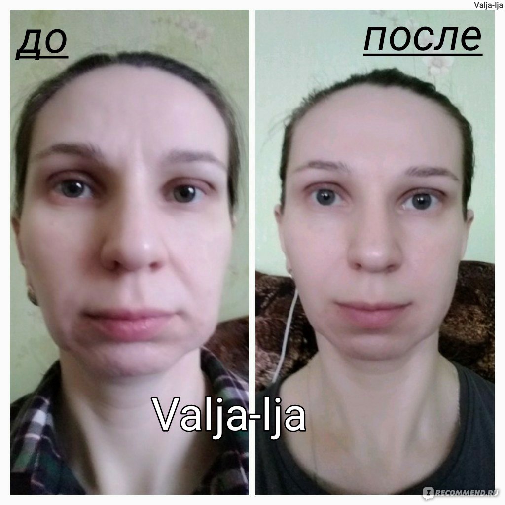 Фейсбилдинг для лица: до и после. гимнастика для лица: упражнения :: syl.ru