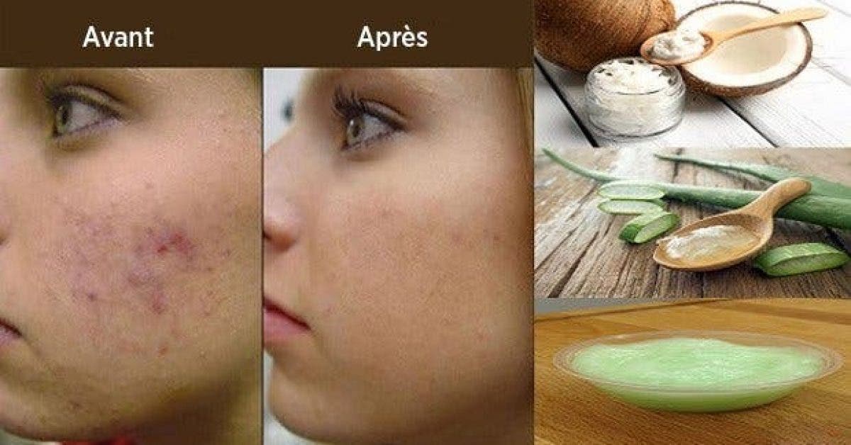 Маски для лица с алоэ — 30 рецептов изготовления в домашних условиях