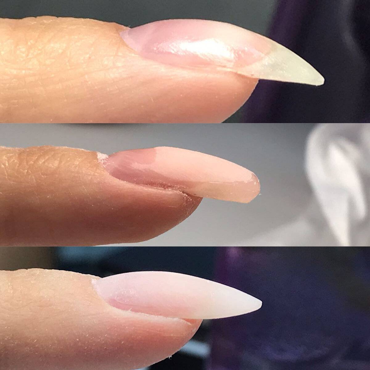 Ногти на руках загибаются вниз: почему они так растут на указательном и других пальцах, каковы причины и что делать, чтобы исправить, какими способами выпрямить?