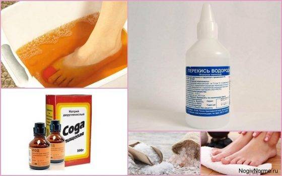 Лечение грибка ногтей йодом: свойства, рецепты, безопасно ли, противопоказания