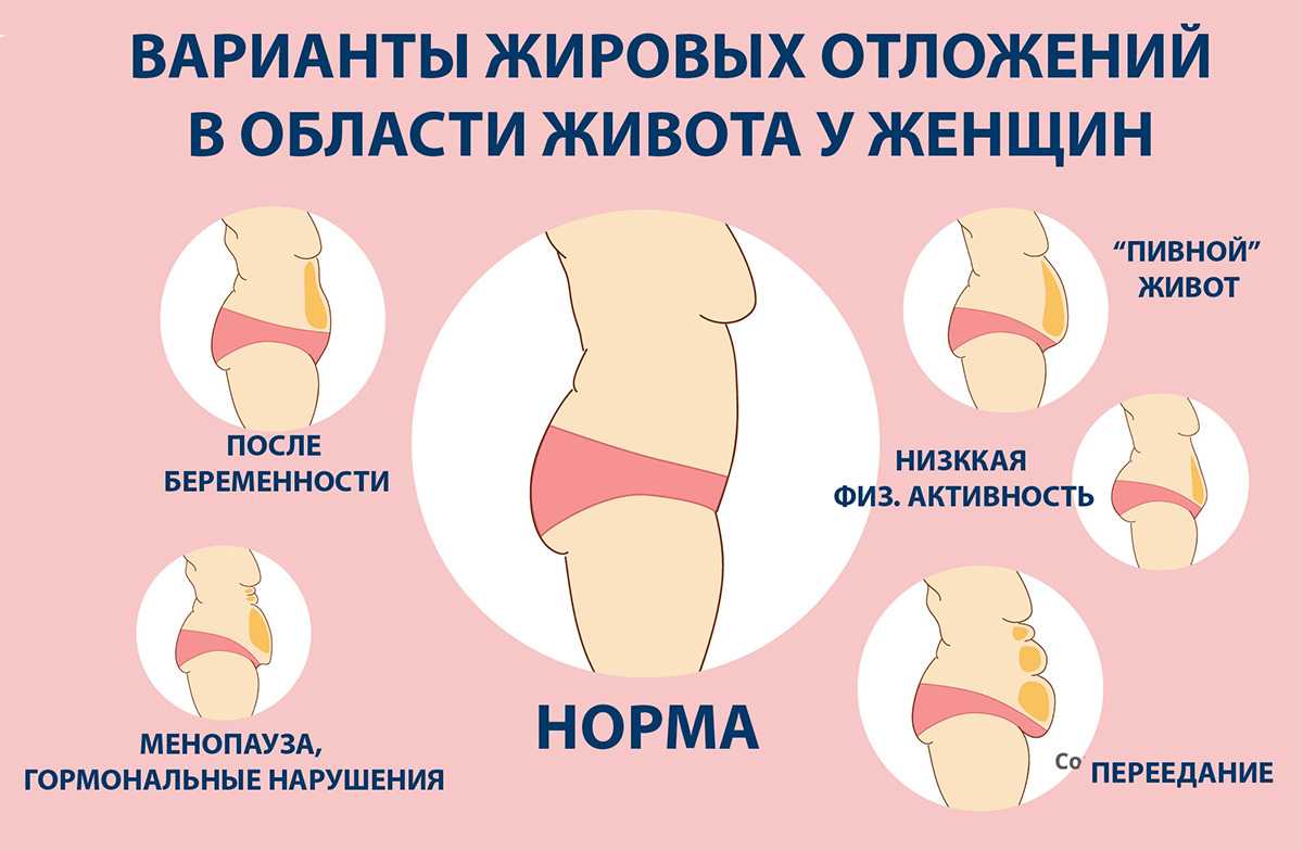 Почему после 50 растет живот у женщин, как убрать жир на животе