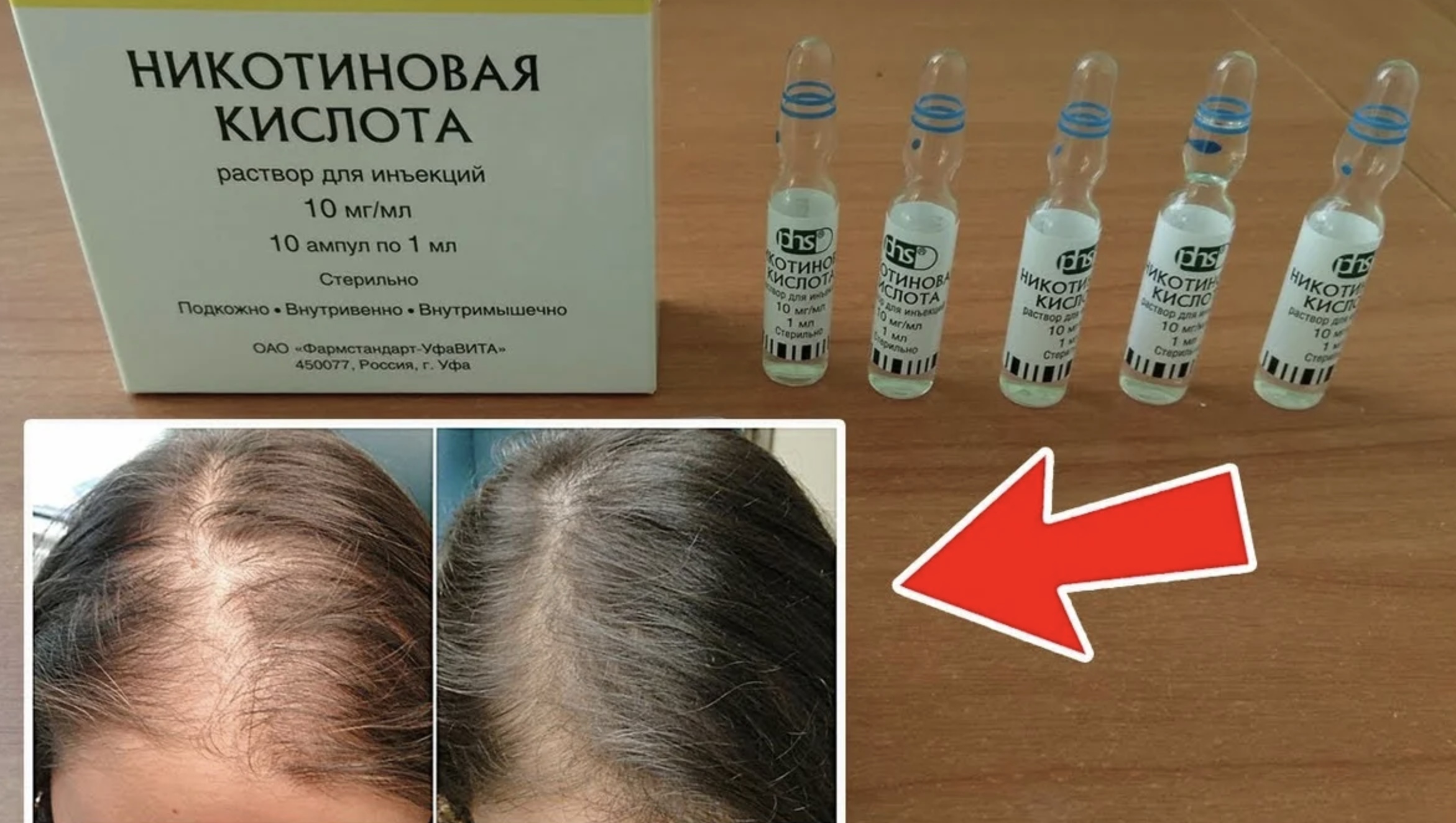Препарат для роста волос для наружного применения