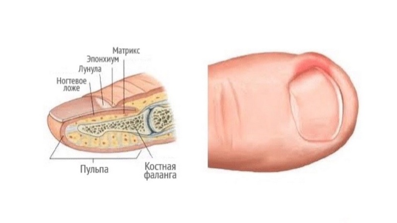 Боль в пальцах ног (болит палец на ноге) - клиника доктора локтионова